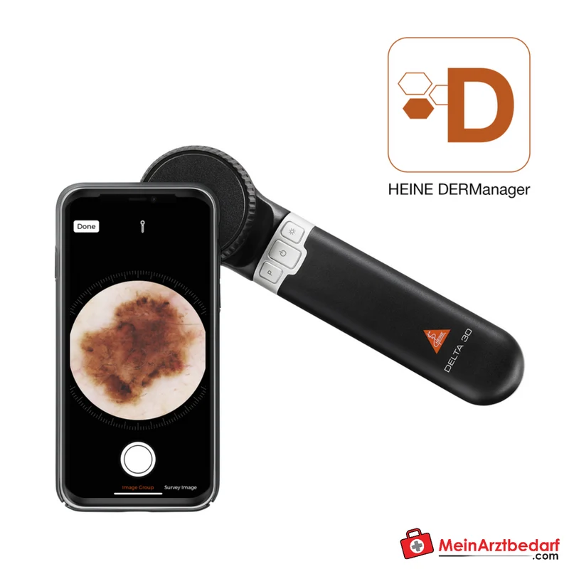 HEINE DELTA 30 Dermatoskop
