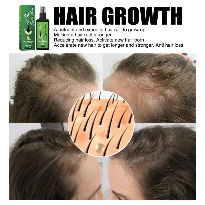 1+1 GRATIS | GrowthPlus™ | Pflegendes Ingwerspray