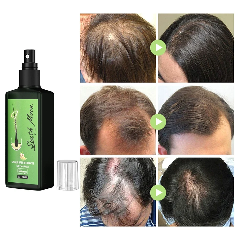 1+1 GRATIS | GrowthPlus™ | Pflegendes Ingwerspray
