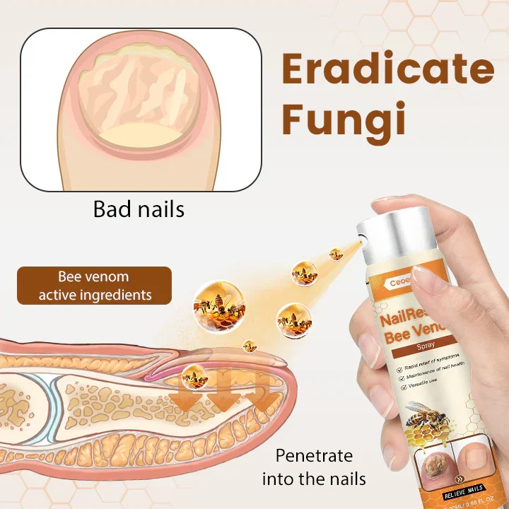 1+1 Gratis | NailRescue™ | Schnelle Heilung, Starkes Nagelbild