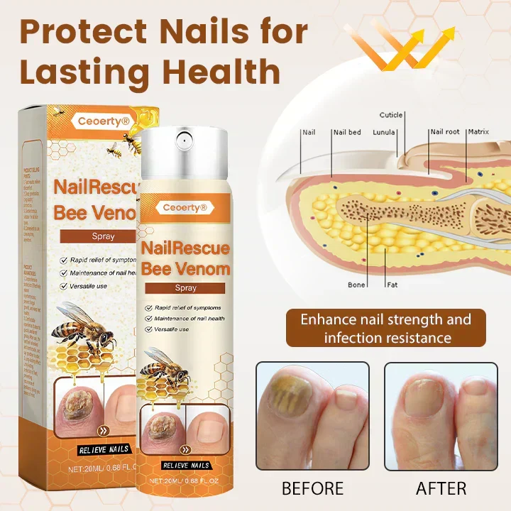 1+1 Gratis | NailRescue™ | Schnelle Heilung, Starkes Nagelbild
