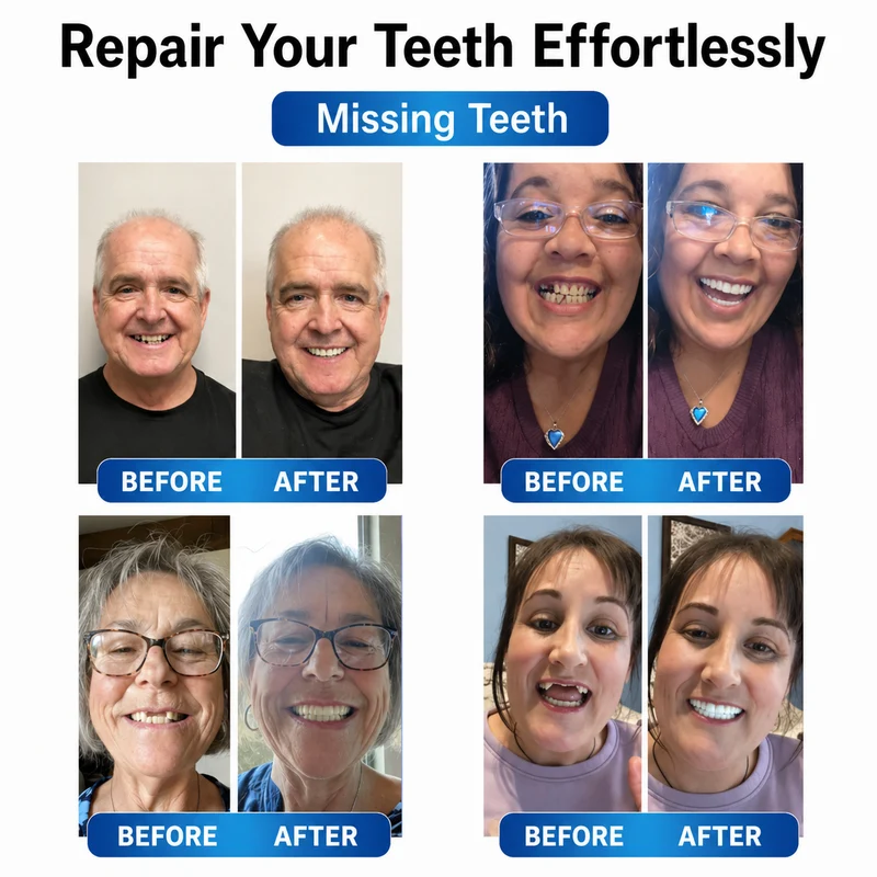 Prothesen | Zahnreparatur Set mit LED | Formbares Denture Gel | Futusly