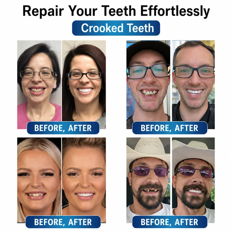 Prothesen | Zahnreparatur Set mit LED | Formbares Denture Gel | Futusly