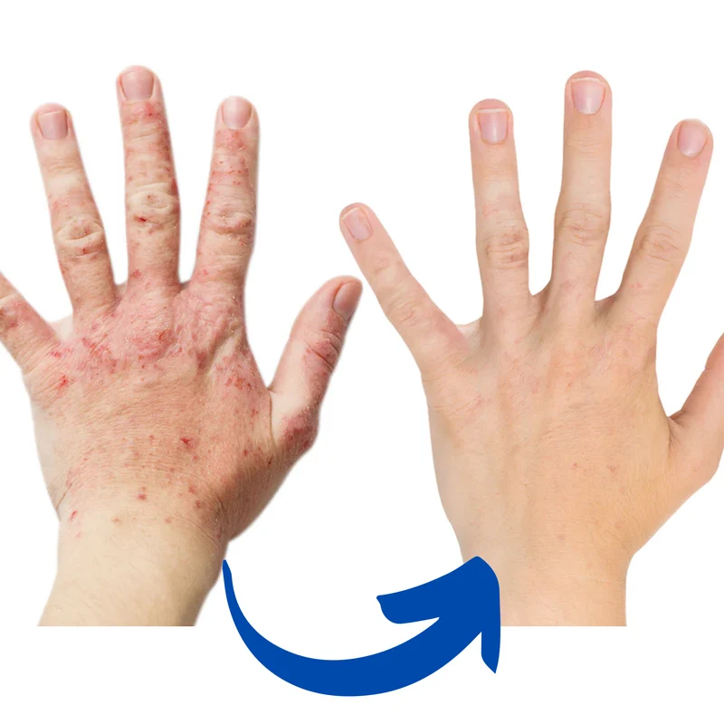 ArthroGlow Infrarot-Handtherapie-Handschuhe zur Linderung von Arthritis-Schmerzen