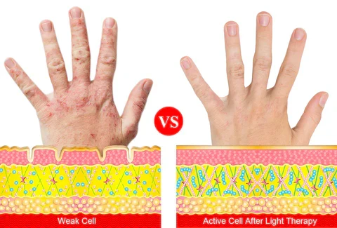 ArthroGlow Infrarot-Handtherapie-Handschuhe zur Linderung von Arthritis-Schmerzen