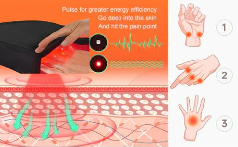ArthroGlow Infrarot-Handtherapie-Handschuhe zur Linderung von Arthritis-Schmerzen