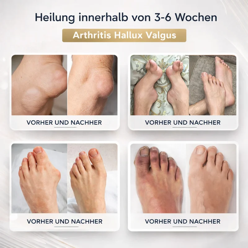 Bienengiftcreme | Salbe mit Bienengift, Hyaluron & Kollagen | BeeLixir