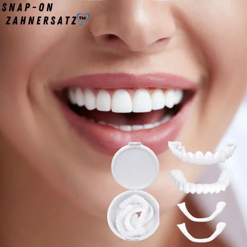 SnapFit Smile - Zahnrestauration für ein perfektes Lächeln ohne Zahnarztbesuch