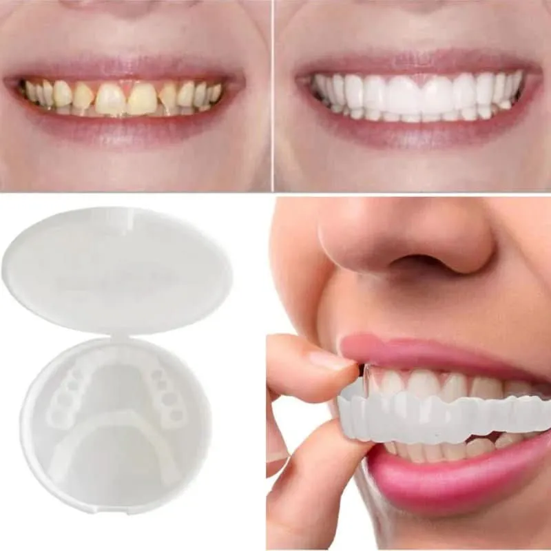 SnapFit Smile - Zahnrestauration für ein perfektes Lächeln ohne Zahnarztbesuch