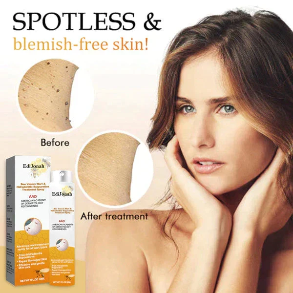SkinClear | Warzenentferner Spray – Sanfte und Effektive Behandlung