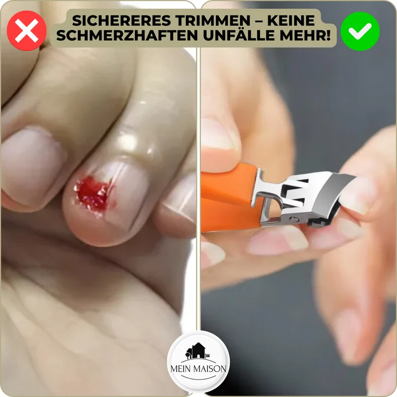 Nagelknipser WideTrim | Extra Breite Schneideöffnung | Anti-Spritz Design | Rostfreier Stahl