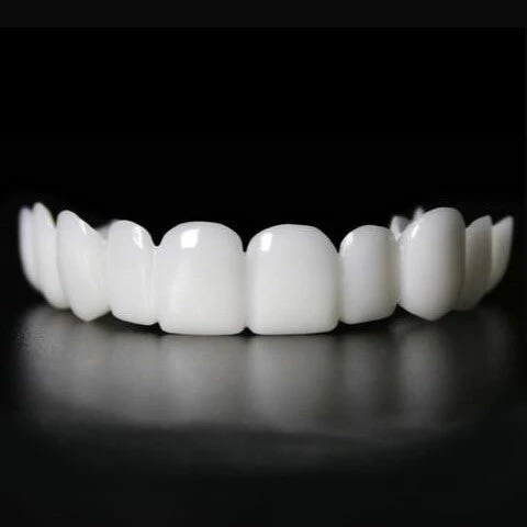 SmileSnap Sofort Veneer Kit für ästhetische Zahnverblendungen