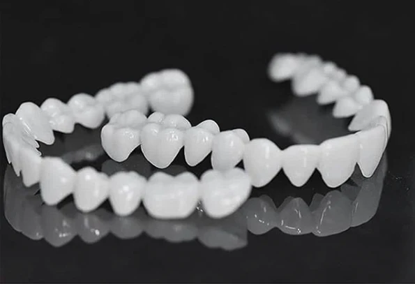 Zahnverblendungen DentAlign – Natürliche Anpassung und Komfort