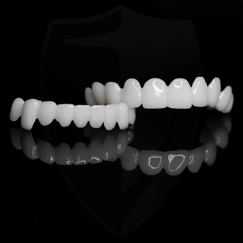 Zahnverblendungen DentAlign – Natürliche Anpassung und Komfort