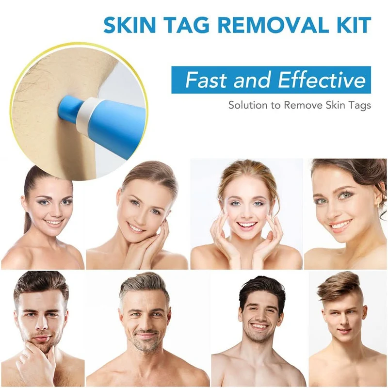 Dermaswift – Hautfleckenentferner Gegen Warzen Und Hautanhänger