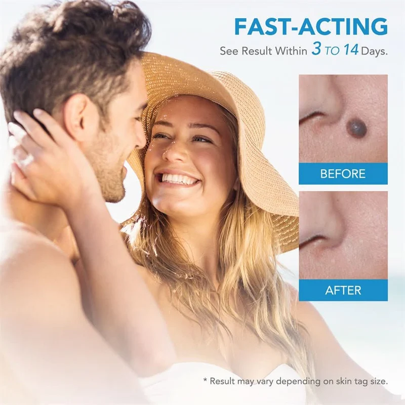 Dermaswift – Hautfleckenentferner Gegen Warzen Und Hautanhänger