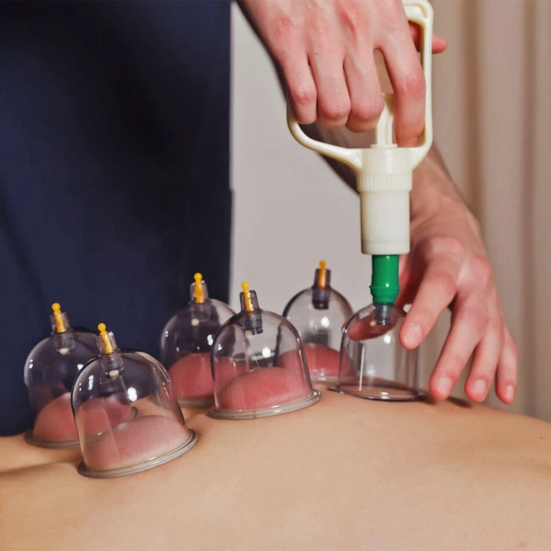 CuppingThera Pro | 32-teiliges Vakuum-Schröpfsatz für Massage & Akupunktur