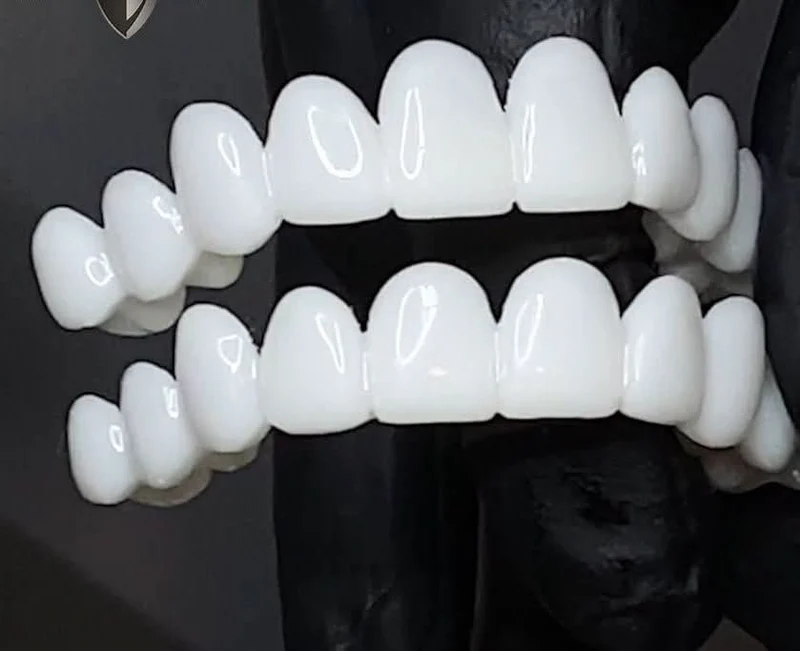 DenturaFlex | Anpassbare, natürlich aussehende Zahnprothese für Komfort