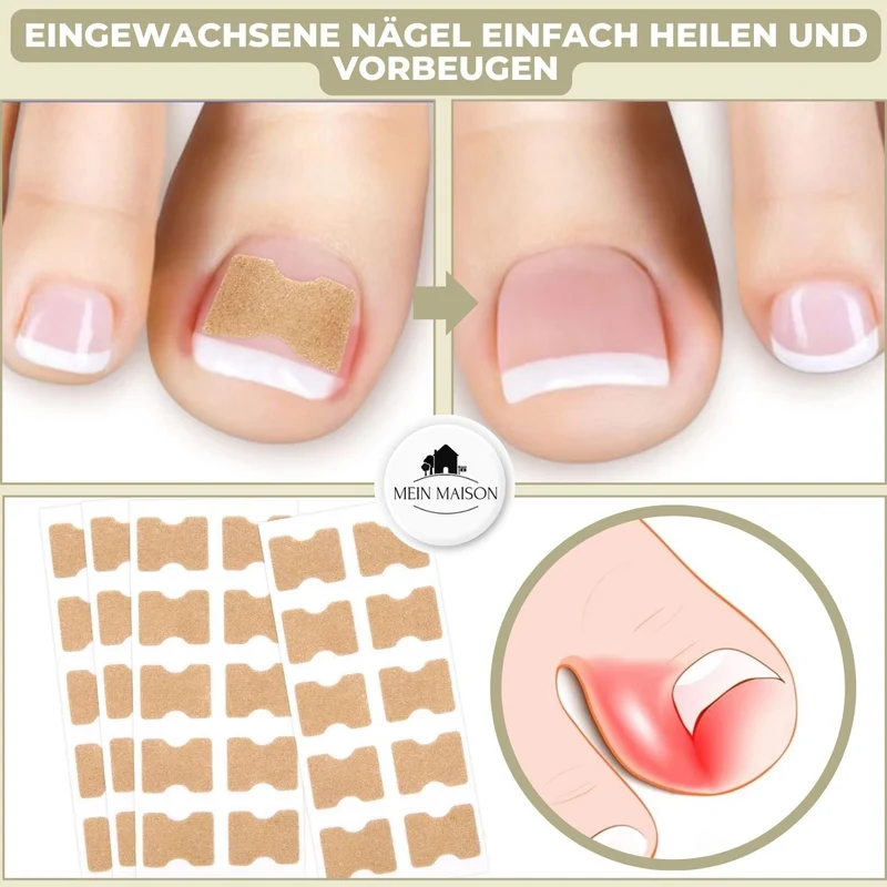10+10 GRATIS | FixaNail - Direkte Nagelreparatur