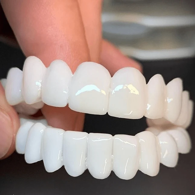 SmileFlex – Anpassbare Zahnprothese mit Dental-Linsen