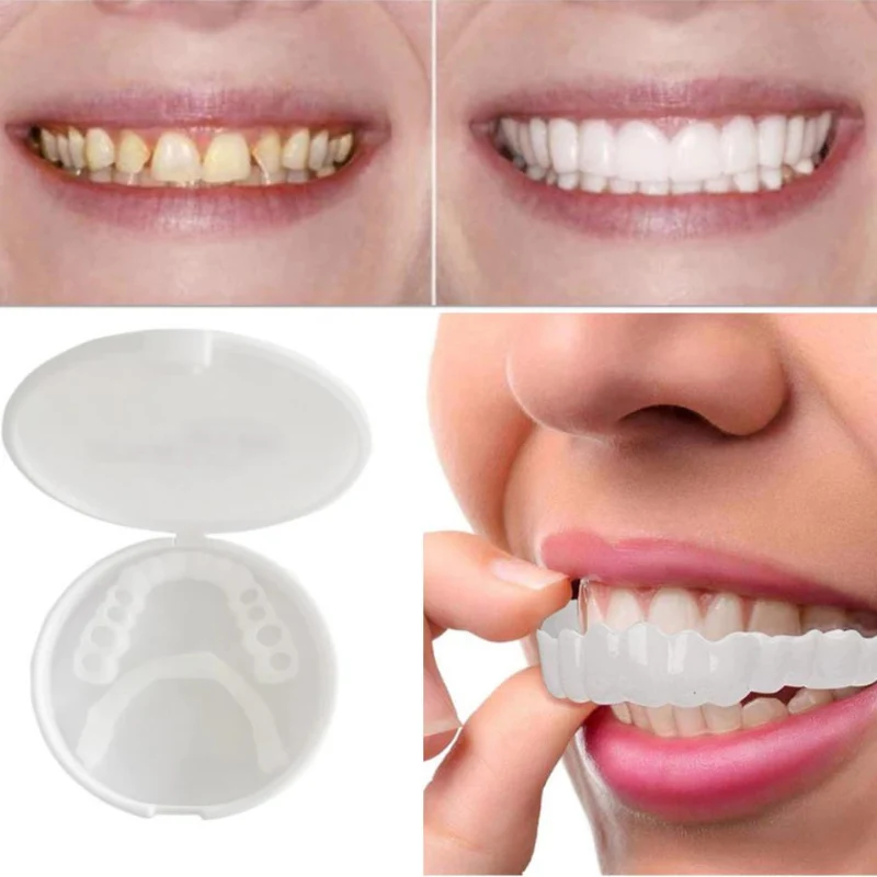 SmilePro | Sofortige bequeme flexible Zahnprothesenlösung