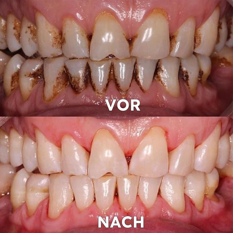 Mineralpulver für Zahnpflege | Zähne Stärken & Schützen | SmileSchutz