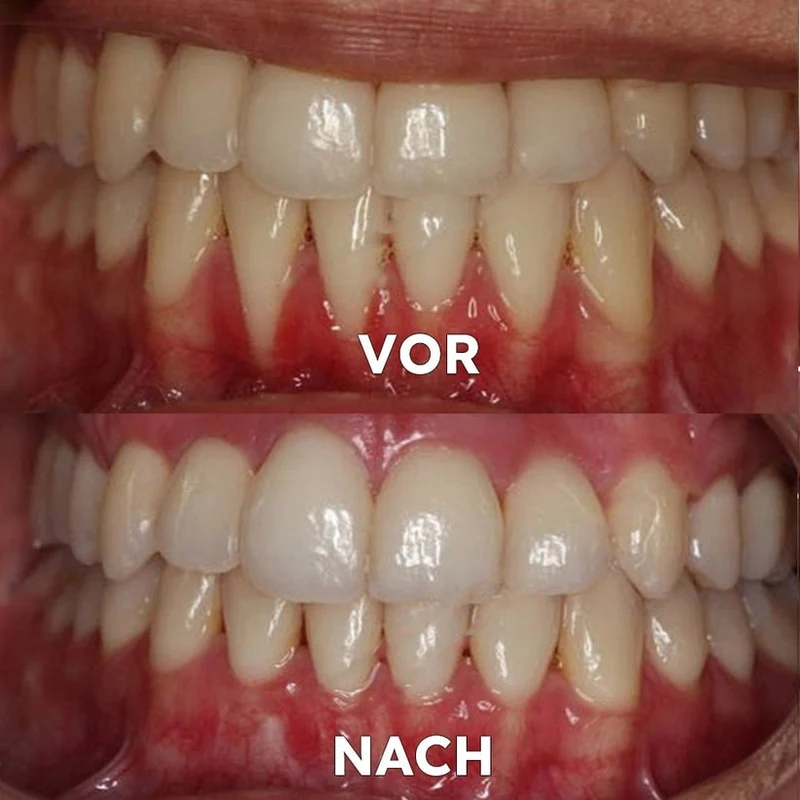 Mineralpulver für Zahnpflege | Zähne Stärken & Schützen | SmileSchutz